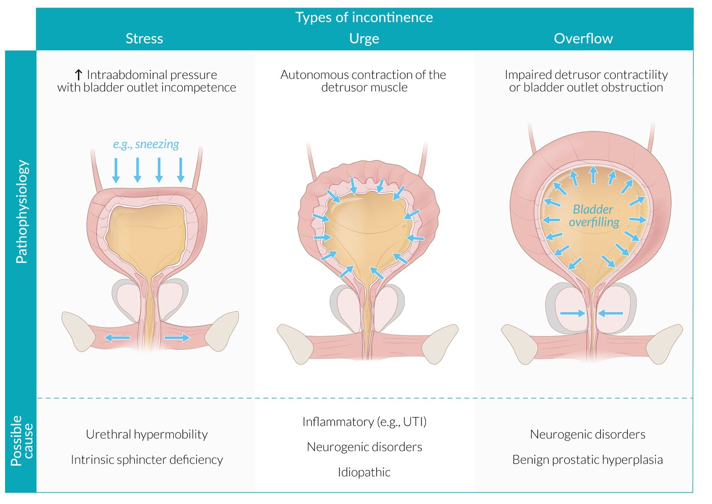 tetanus vaccine algorithm